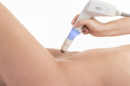 Laser Vulvar Skin Tightening treatment Ghaziabad