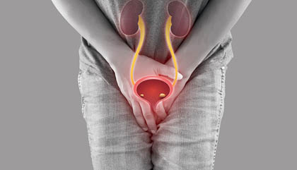 Urinary incontinence treatment Ghaziabad